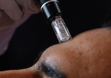 Microneedling: Was steckt dahinter?
